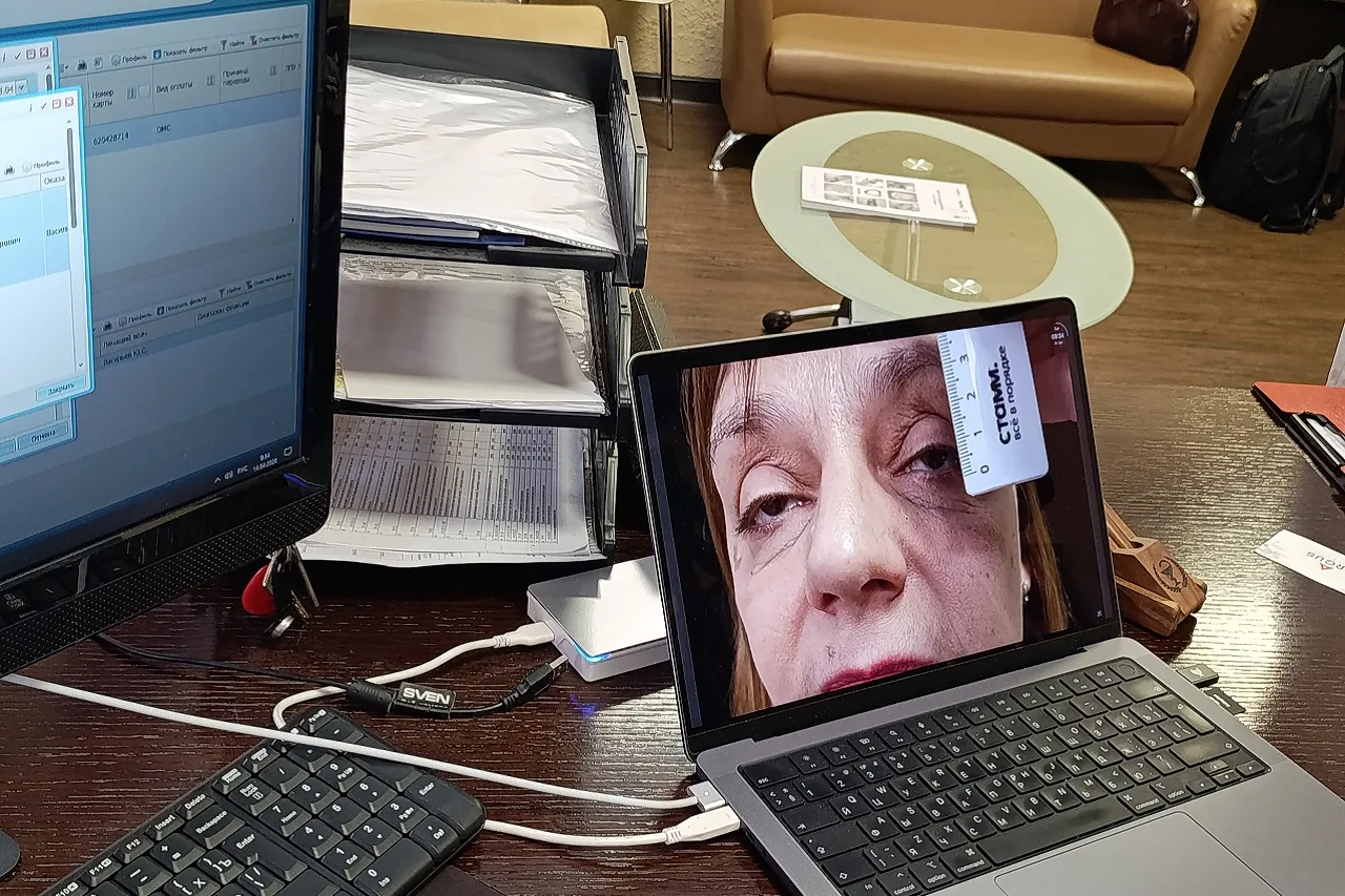 В Челябинске прооперировали пациенток с редкой патологией век