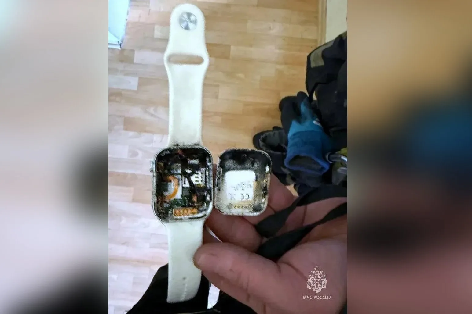 В Челябинске у школьника прямо на уроке вспыхнули смарт-часы