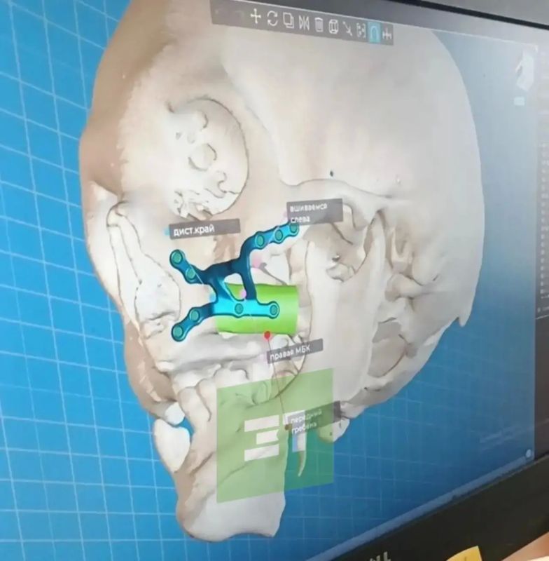 Восстановили лицо с помощью 3D-технологий Восстановили лицо с помощью 3D-технологий