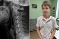 В Челябинске спасли подростка, которому разрезало шею проволокой