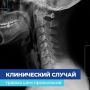 Чудом не истёк кровью: хирурги ЧОДКБ спасли подростка