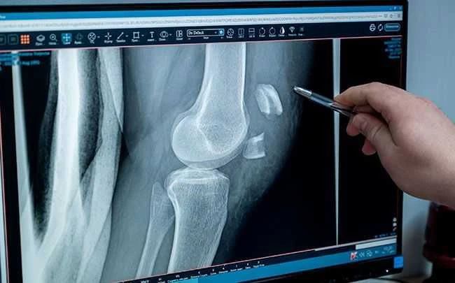 Южноуральцев ждет непростая погодная обстановка: резкое похолодание приведет к гололедице на дорогах и тротуарах